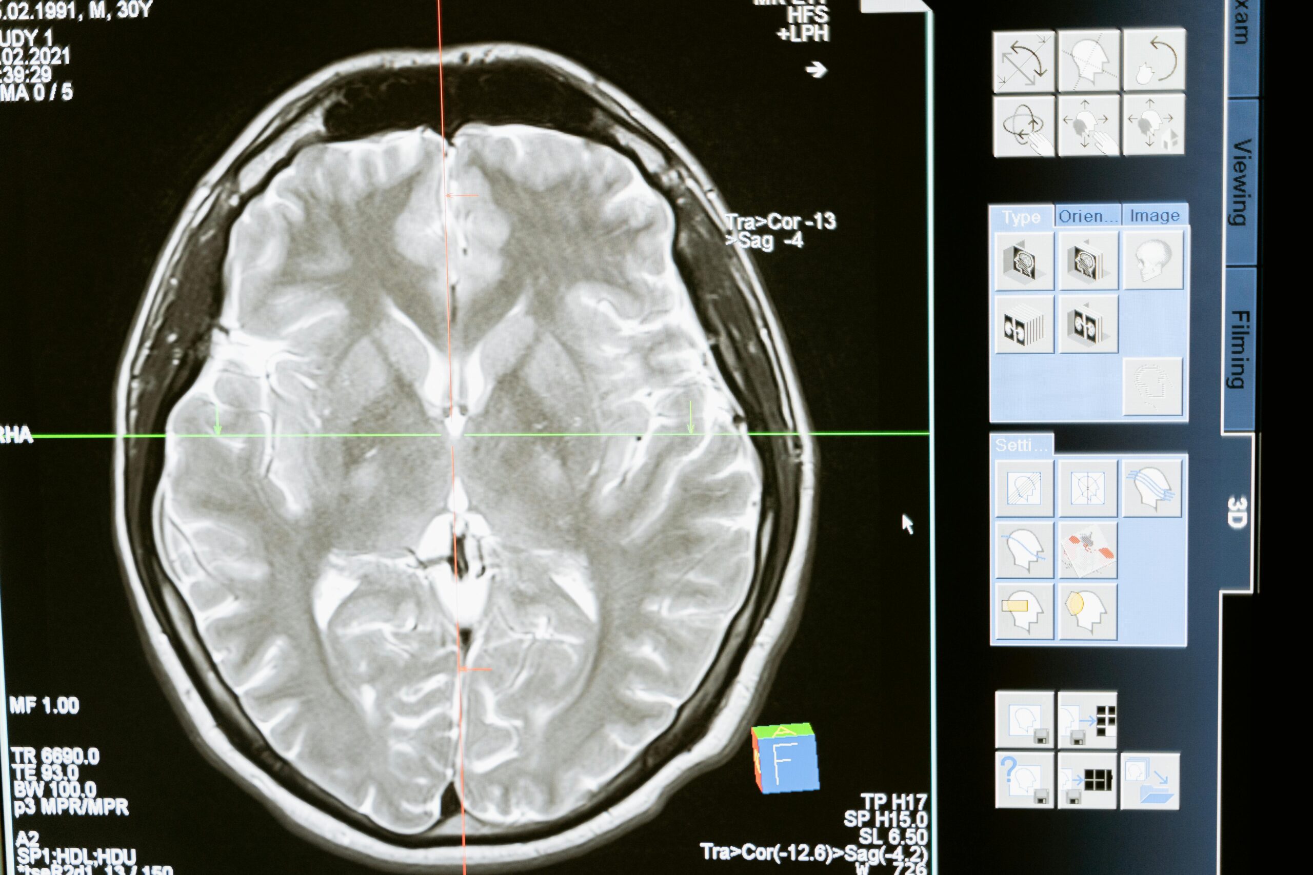 The Secrets of Neurology