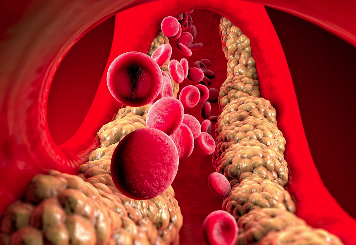 Alzheimer’s disease gut flora, lipid metabolism and biological aging in 2025