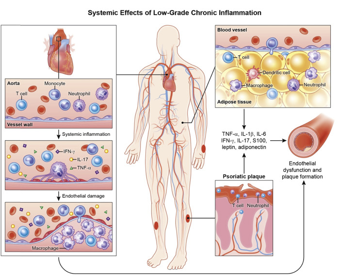 Unsaturated fats are not always anti -inflammatory, per a study in 2025